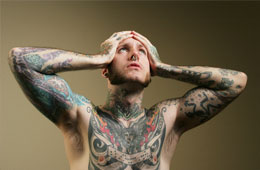 tattoo removal